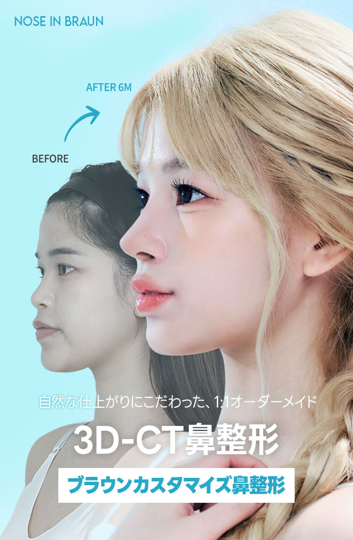 /jp/data/apms/background/3DCT코성형.jpg