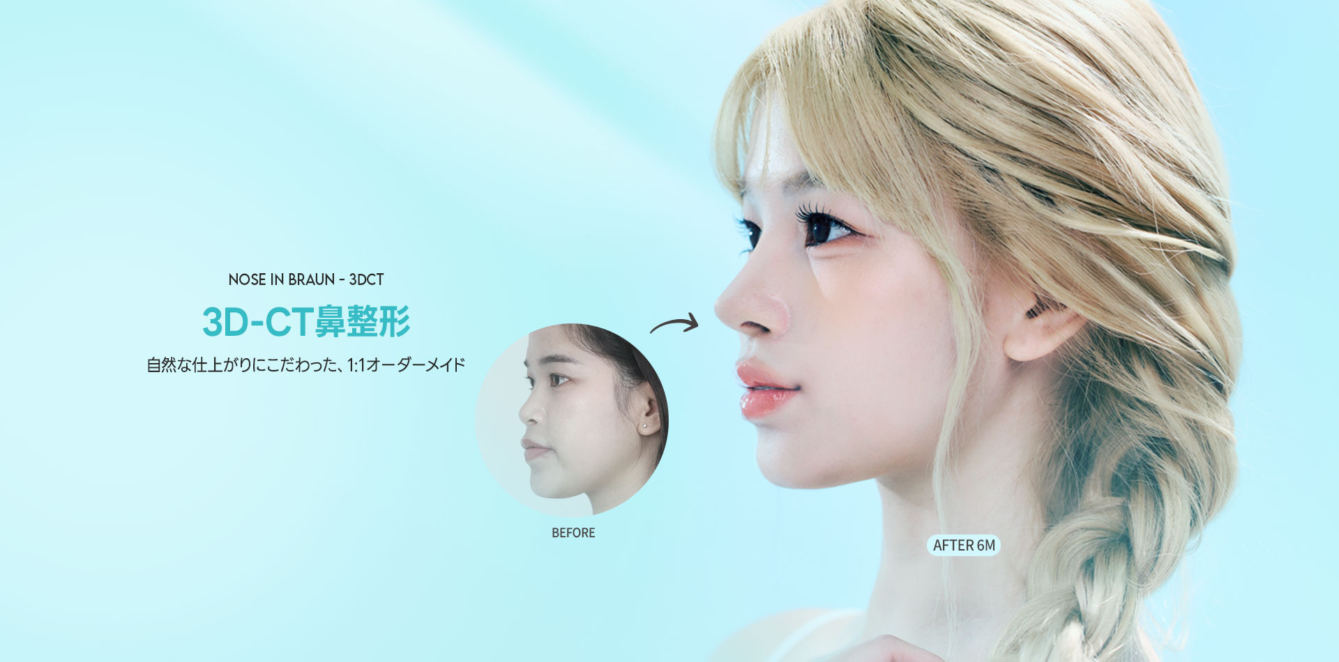 /jp/data/apms/background/3DCT코성형.jpg