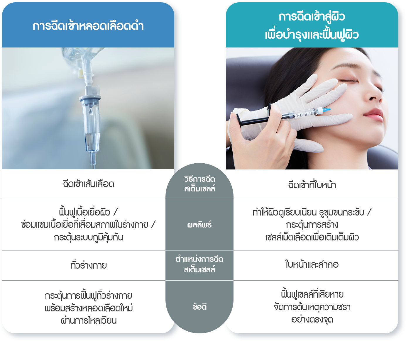 줄기세포 시술방법