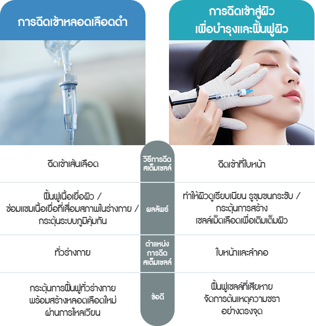 줄기세포 시술방법