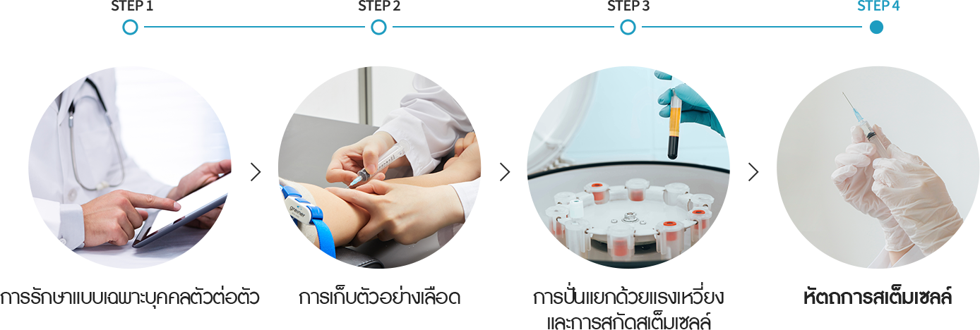줄기세포 시술방법